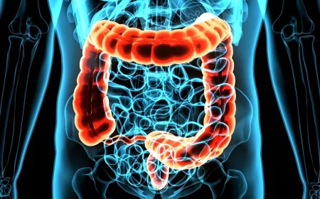 Rectal Cancer Now One-Third of All Colorectal Diagnoses in US Study