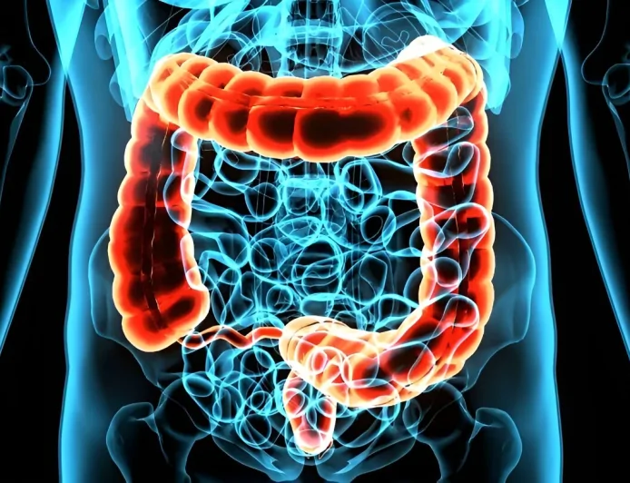 Rectal Cancer Now One-Third of All Colorectal Diagnoses in US Study